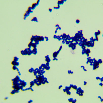 Ruminococcus gnavus Moore et al. VPI C7-9-BNCC