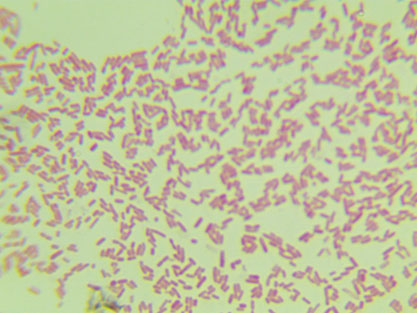 Photorhabdus luminescens subsp.‖luminescens (Thomas and Poinar) Boemare et al.-BNCC