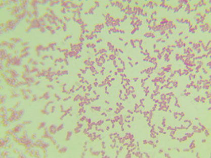 Escherichia coli-BNCC