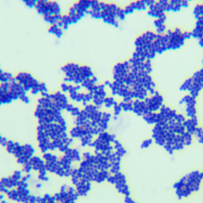 Streptococcus anginosus-BNCC