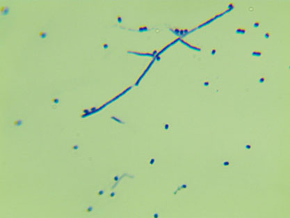 Streptomyces griseus (Krainsky) Waksman et Henrici-BNCC