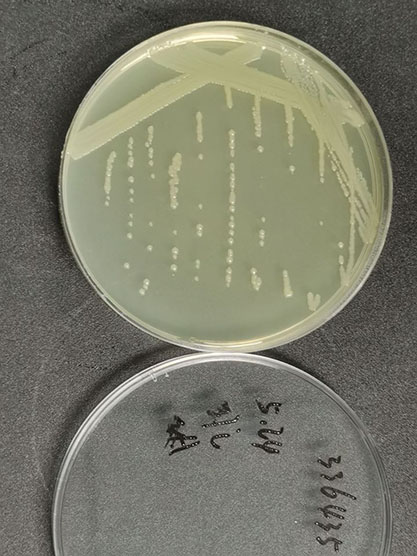 Escherichia coli (Migula)CastellanietChulmers-BNCC