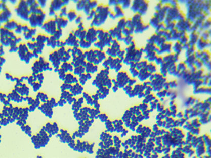 Streptococcus faecalis Andreweset Horder-BNCC