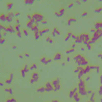 Escherichia coli-BNCC