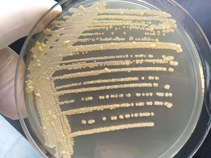 Streptomyces fradiae(Ganseetal.)YanetDeng-BNCC