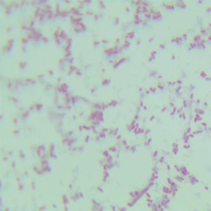 Escherichia coli (Migula) Castellani et Chalmers-BNCC