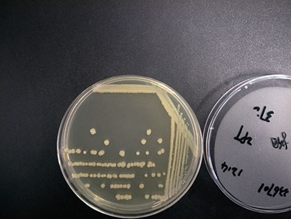 Yersinia pseudotuberculosis-BNCC