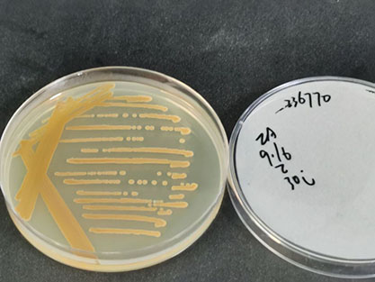 Bacillus subtilis-BNCC