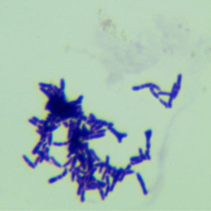 Bifidobacterium bifidum-BNCC