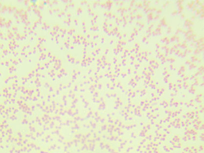 Salmonella enterica subsp.enterica-BNCC