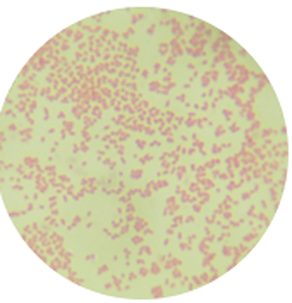 Aggregatibacter actinomycetemcomitans-BNCC