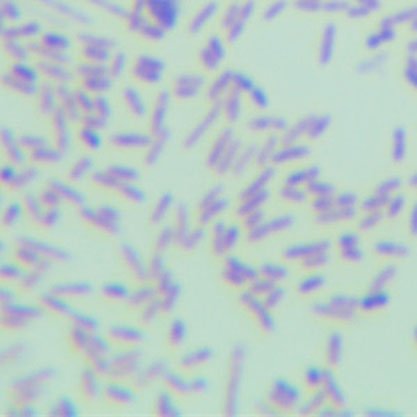 Bacteroides fragilis-BNCC