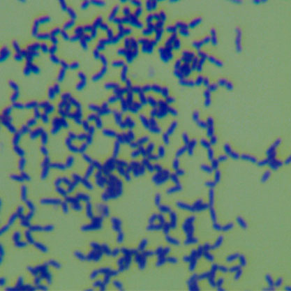 Rhodococcus opacus-BNCC