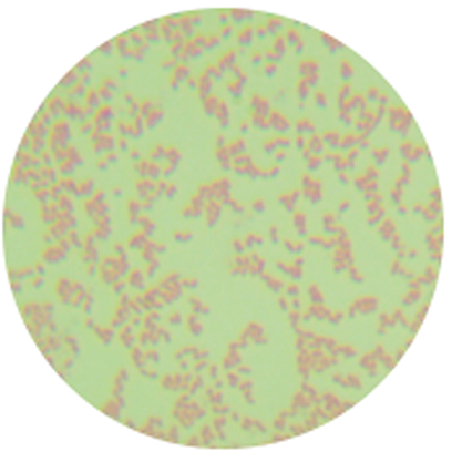 Aggregatibacter actinomycetemcomitans-BNCC