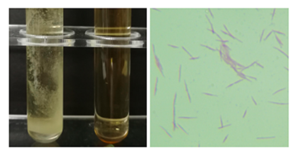 Fusobacterium nuclei subspecies-BNCC