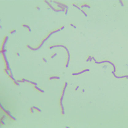 Bacteroides vulgatus-BNCC