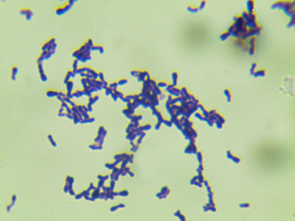 Bifidobacterium bifidum-BNCC