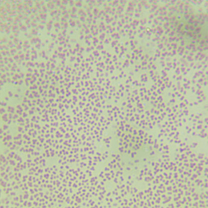 Haemophilus influenzae-BNCC