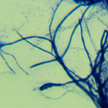 Streptomyces microflavus-BNCC
