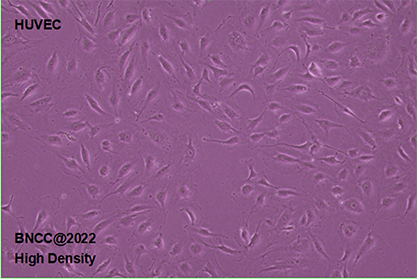 Human umbilical vein endothelial cells-BNCC