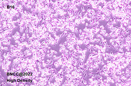 Mouse melanoma cells-BNCC