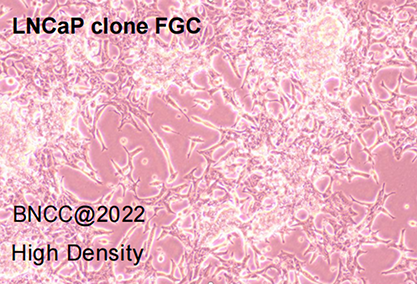Human prostate cancer cells-BNCC