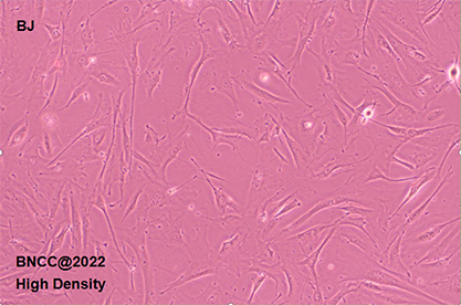 Human skin fibroblasts-BNCC