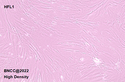 Human embryonic lung fibroblasts-BNCC