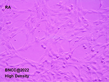 Rat astrocytes-BNCC
