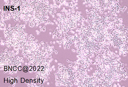 Rat islet cell tumor cells-BNCC