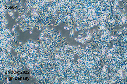 Human nasopharyngeal carcinoma cells-BNCC