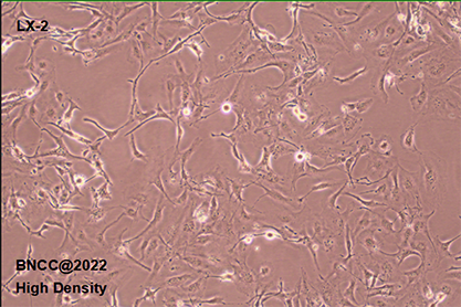Human hepatic stellate cells-BNCC