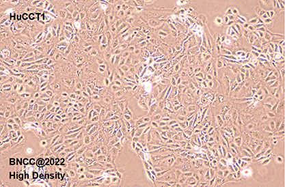 Human cholangiocarcinoma cells-BNCC