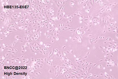 Human bronchial epithelial cells-BNCC