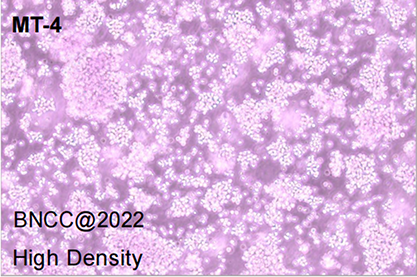 Human acute lymphoblastic leukemia cells-BNCC