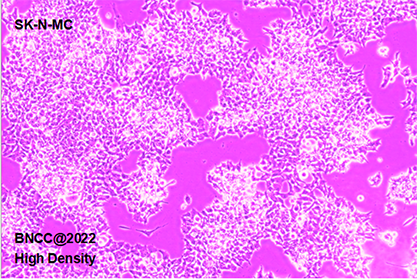 Human neuroepithelioma cells-BNCC