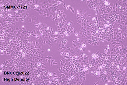 Human hepatoma cells (recognized as contaminated by HELA)-BNCC