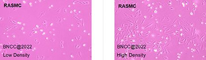 Rat aortic smooth muscle cells-BNCC