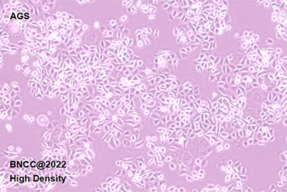 Human gastric adenocarcinoma cells-BNCC