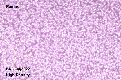 Human B lymphoma cells-BNCC