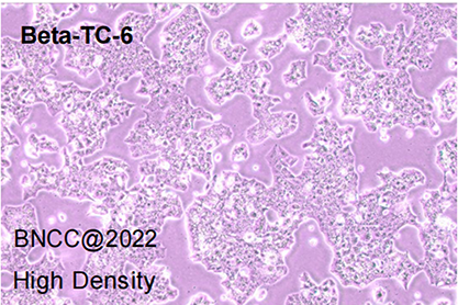 Mouse insulinoma islet beta cells-BNCC