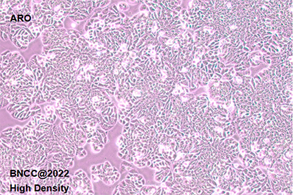 Human thyroid cancer cells (undifferentiated) (recognized as contaminated by HT-29 cells)-BNCC