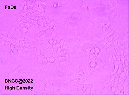 Human pharyngeal squamous cell carcinoma-BNCC