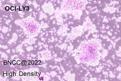 Human diffuse large B- cell lymphoma cells-BNCC