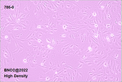 Human renal clear cell adenocarcinoma cells-BNCC