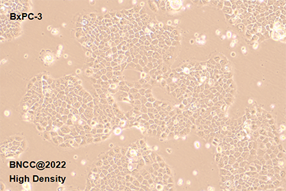 Human in situ pancreatic adenocarcinoma cells-BNCC