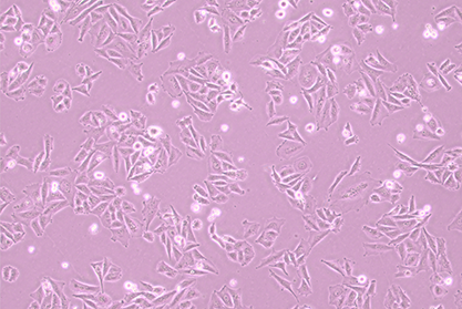 human osteogenic sarcoma cells-BNCC