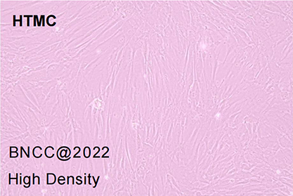 trabecular meshwork cell of human eye-BNCC