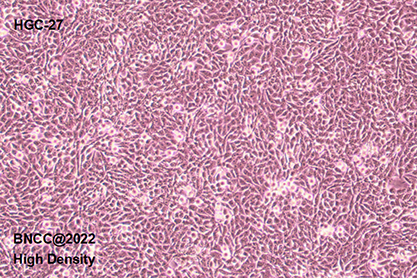 Human gastric cancer cells (undifferentiated)-BNCC