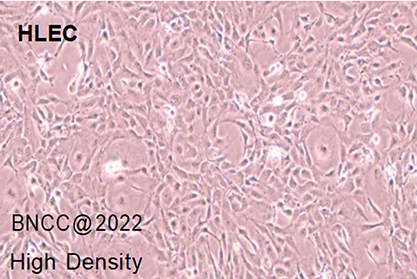 human lymphoendothelial cells-BNCC